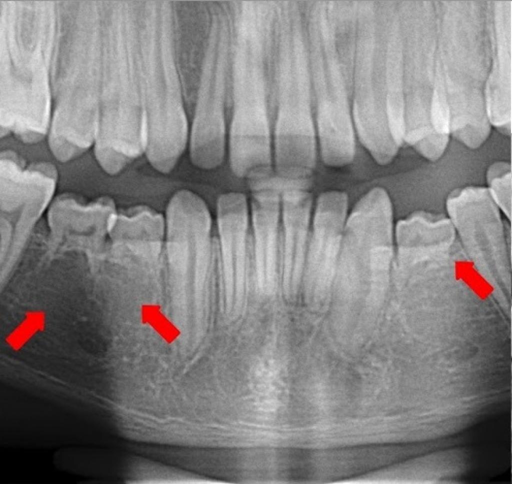 Dente de leite na vida adulta, você já ouviu falar?